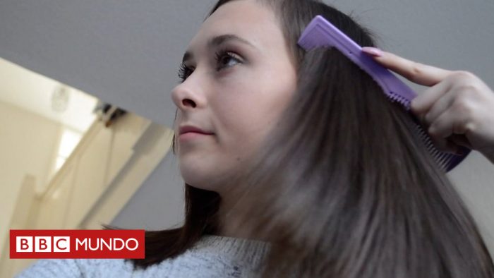 [VIDEO] «Llegué a ser adicta a arrancarme el cabello»: el conmovedor testimonio de Megan Malone, una adolescente que padeció tricotilomanía