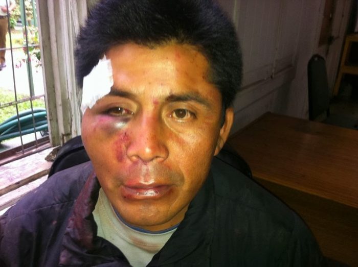 Justicia formaliza a carabinero por apremios ilegítimos contra comunero mapuche en 2014