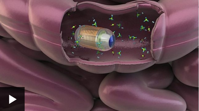 [VIDEO] Así funciona la cápsula que mide los gases en tu intestino