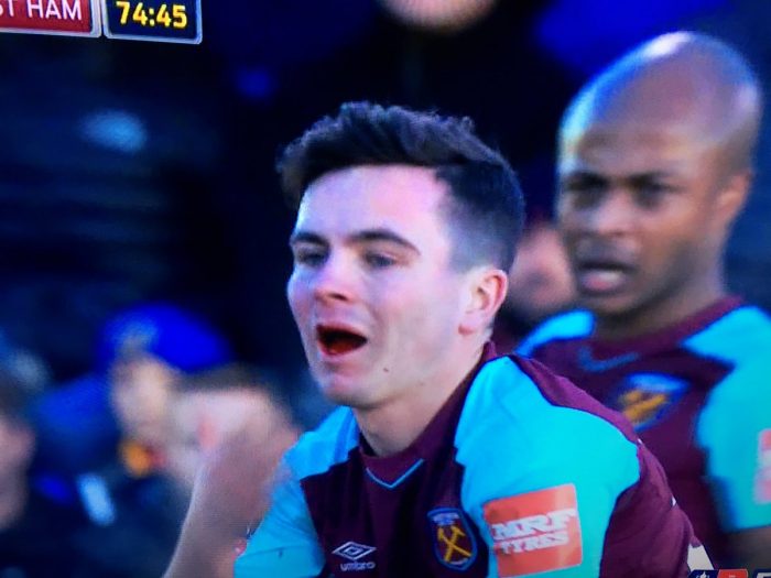 [VIDEO] Joven futbolista del West Ham pierde un diente tras recibir brutal patada en la cara