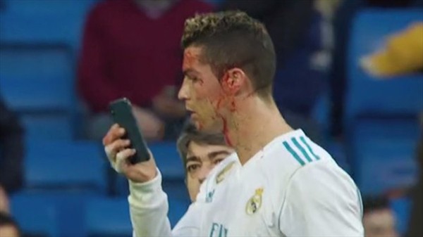 [VIDEO] Cristiano Ronaldo sufre herida en su cara luego de una patada y pide su celular para verse el corte