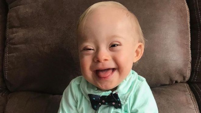 Lucas Warren, el bebé con síndrome de Down que será el rostro de la marca de comida para niños Gerber