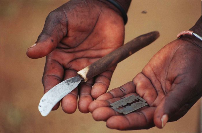 Mutilación genital femenina: La terrible costumbre que afecta a millones de niñas cada año
