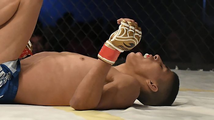 [VIDEO] La dolorosa fractura que tiene competidor de la MMA en plena competencia