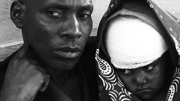 “Mi hija fue atacada a machetazos”: el drama de las familias atrapadas en la espiral de violencia que afecta a República Democrática del Congo