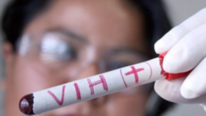 Psicóloga se une a opinión de organizaciones sobre VIH en jóvenes: «Se desinformó a la sociedad con campañas moralistas»