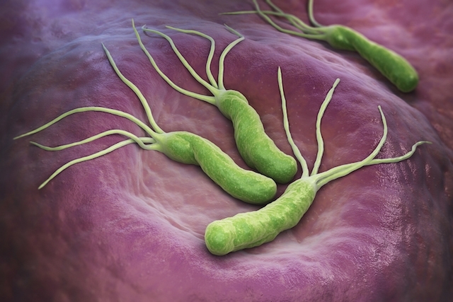 Expertos en gastroenterología recomiendan incluir test no invasivos en canasta ges para detectar Helicobacter Pylori