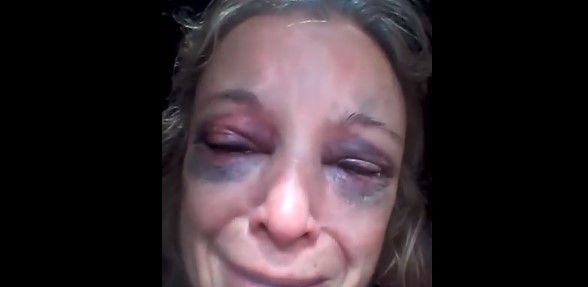 Mujer se niega a tener relaciones sexuales con un hombre y él la golpea con un ladrillo en la cara