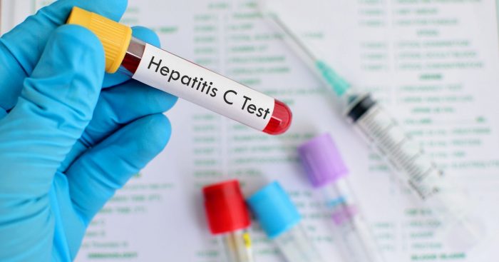 Hepatitis C: la enfermedad ignorada, oculta y olvidada