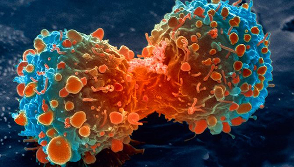 Células que cicatrizan heridas aceleran la metástasis en cáncer