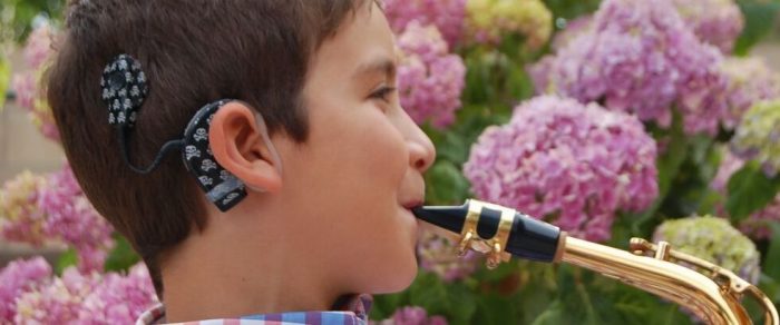 Implante coclear: la revolución del oído digital
