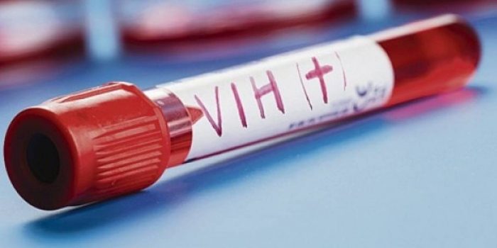 Infectólogo: “La transmisión del VIH también está relacionada con un tema tabú: la práctica del sexo anal sin utilizar métodos de barrera”