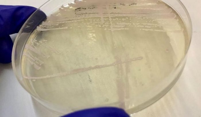 Confirman presencia de peligroso hongo Candida auris en paciente en Chile