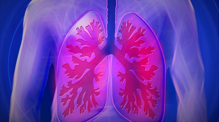 ¿Tiene tos y siente falta de aire y dificultad para respirar? Puede ser fibrosis pulmonar idiopática