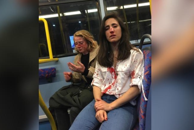 Ataque lesbofóbico: la brutal golpiza que recibió una pareja de lesbianas en Londres