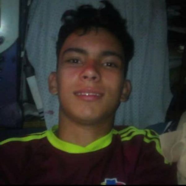 «Mi hijo se quiere matar»: el testimonio de la madre del joven al que dejó sin ojos la policía de Venezuela