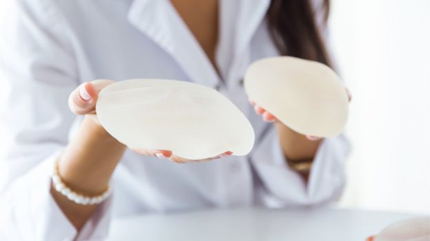 Qué es la enfermedad por implantes mamarios que no tienen base científica pero que sufren miles de mujeres