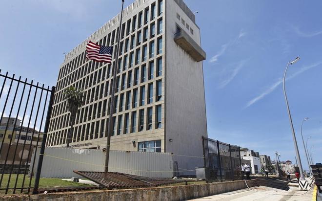Estudio de EE.UU. concluye que «algo le pasó a los cerebros» de sus diplomáticos en Cuba