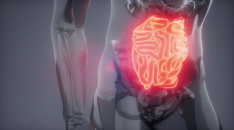 La sobrevivencia al cáncer digestivo