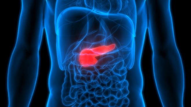 Cáncer de páncreas: la combinación de 2 fármacos que «mata de hambre» a las células cancerosas