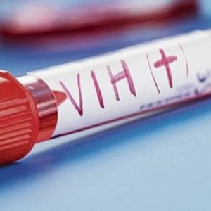La discriminación como causa de la epidemia del VIH
