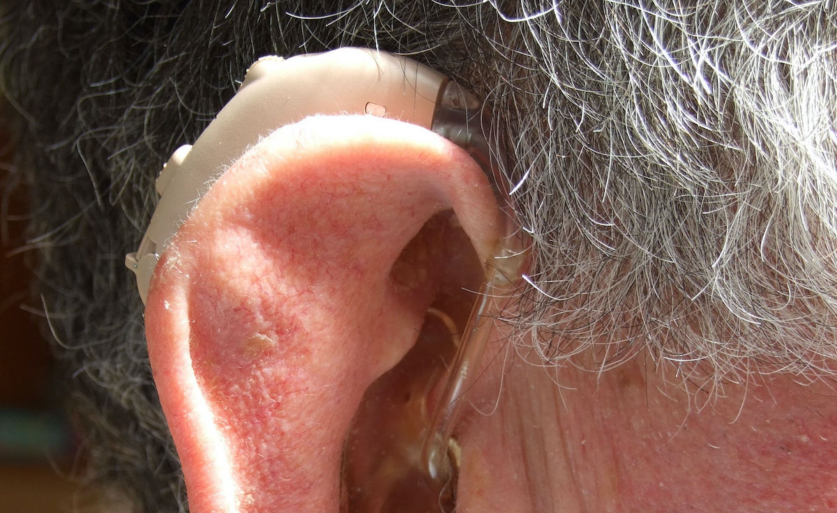 especificación roble Loza de barro Estudio confirma que nivel socioeconómico también se relaciona con uso de  audífonos en adultos mayores