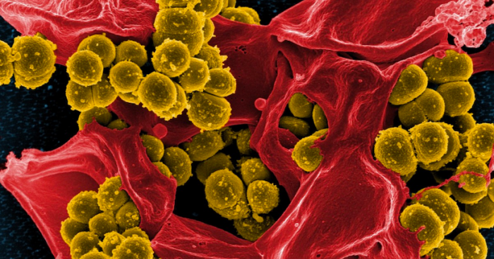 Científica chilena encuentra pista clave para  combatir las infecciones bacterianas mortales
