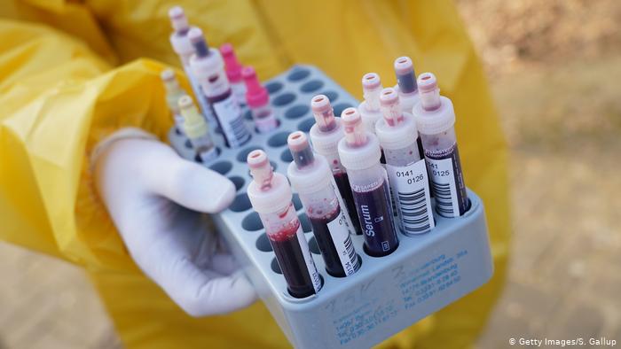 Alemania lanzará estudio sobre magnitud de la inmunidad al coronavirus