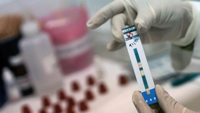 Los médicos confirman la segunda curación del mundo de un paciente con VIH