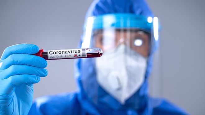 Coronavirus: Qué es el «plasma convaleciente», el tratamiento con el que algunos hospitales buscan salvarles la vida a pacientes de covid-19
