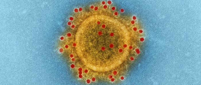 Científicos estudian una posible mutación del coronavirus en Región de Magallanes