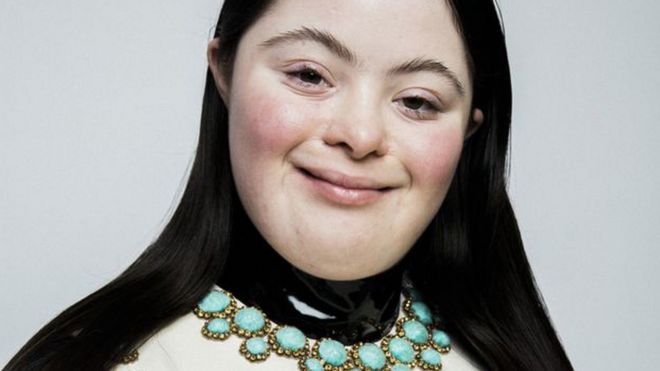 Quién es Ellie Goldstein, la primera modelo con síndrome de Down en aparecer en Vogue