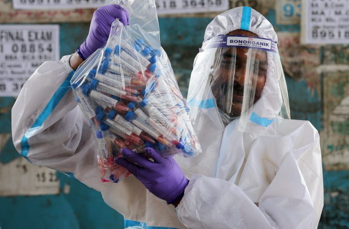 Casos globales llegan a 30,4 millones tras nuevo récord diario de contagios