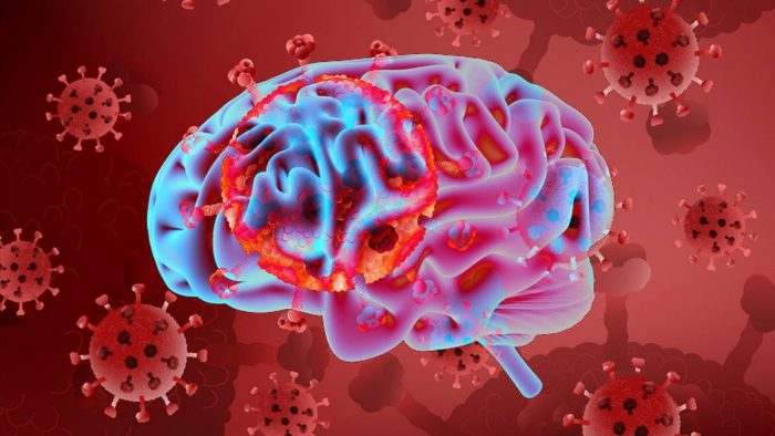 Neurociencias: los ciclos circadianos y el infarto cerebral