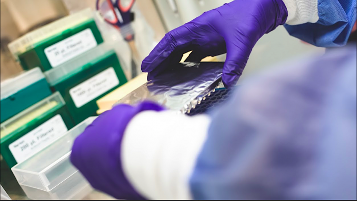 Más de 840 mil PCR han sido analizados por los laboratorios universitarios