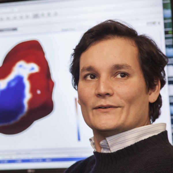 Ingeniero chileno creó un modelo artificial de corazón