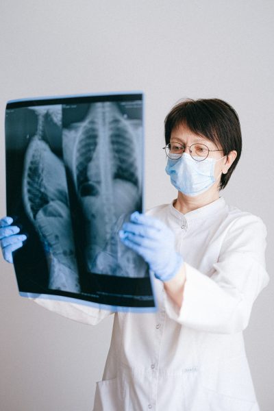Médicos crean fundación para buscar apoyo para los más de 7.500 pacientes con fibrosis pulmonar en Chile