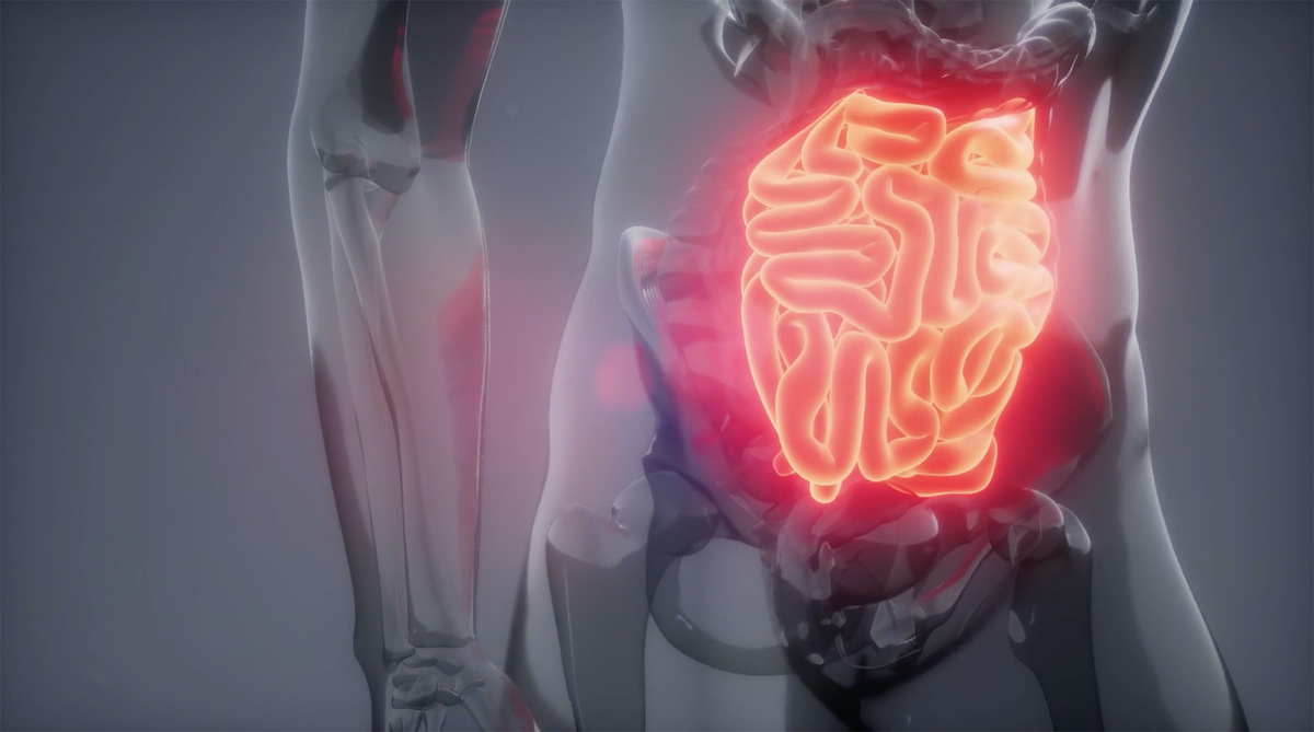 El cáncer de estómago es la cuarta causa de muerte por cáncer en Chile y aún se detecta en etapas avanzadas