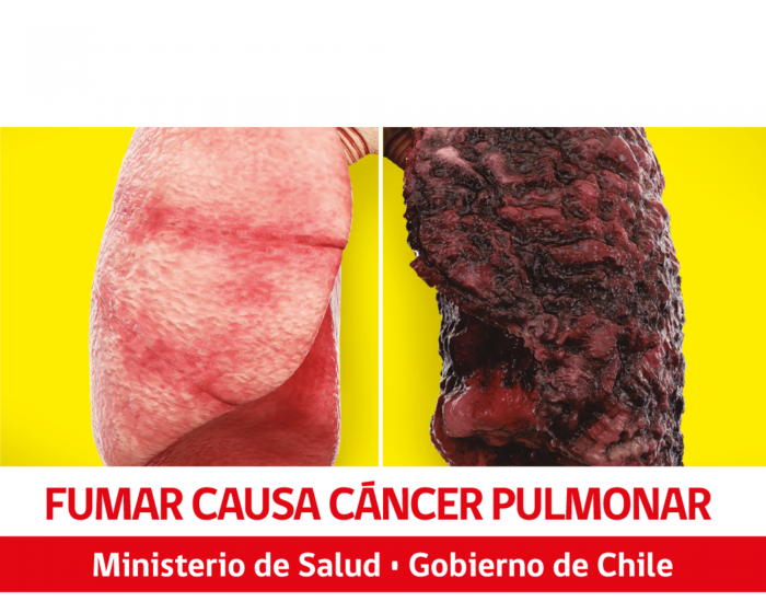 Imágenes más explícitas sobre los efectos del cigarro: Minsal lanza campaña de advertencia en productos con tabaco