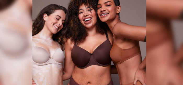«Todos los cuerpos son válidos»: campaña promueve la inclusión real con modelos con estrías, celulitis y vitíligo