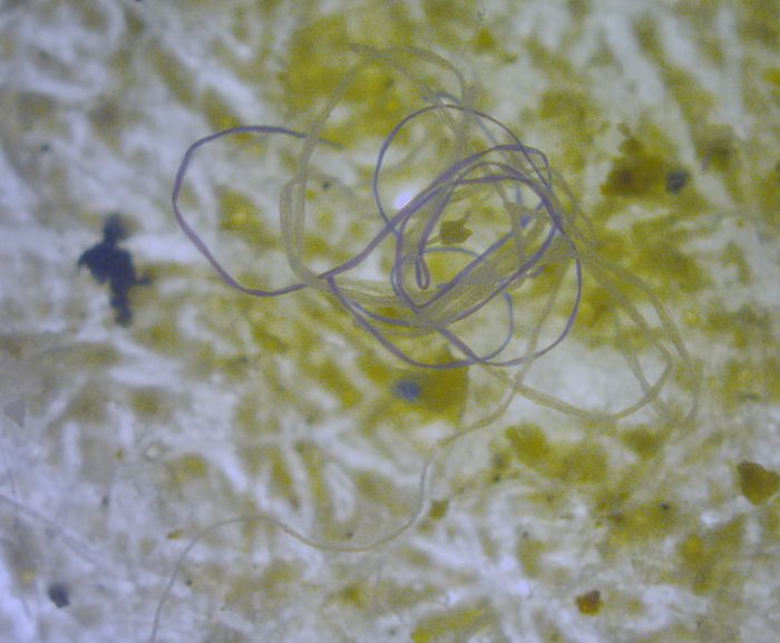 Encuentran por primera vez microplásticos en el torrente sanguíneo humano