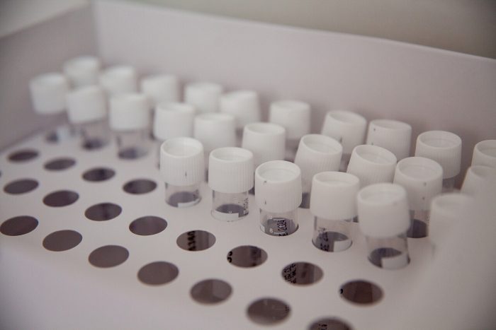 Reporte diario Covid-19: 8.513 casos nuevos, 23 fallecidos y positividad llega al 11,44%