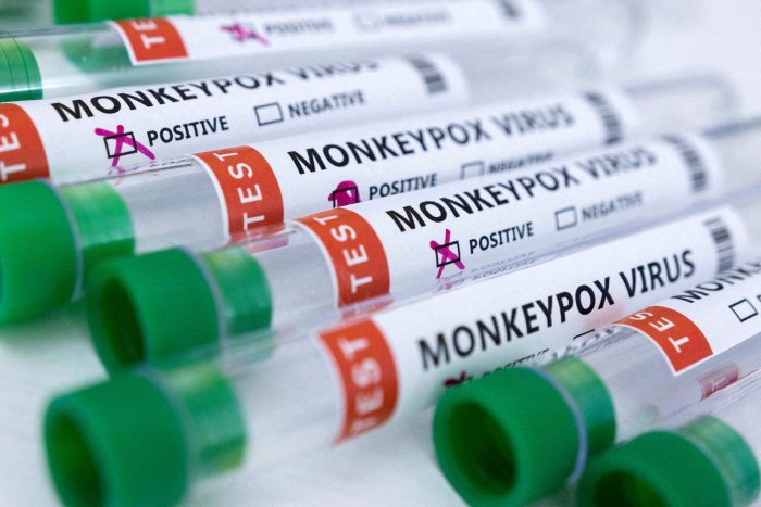 Comité de la OMS se reunirá para decidir si declara emergencia internacional por viruela del mono