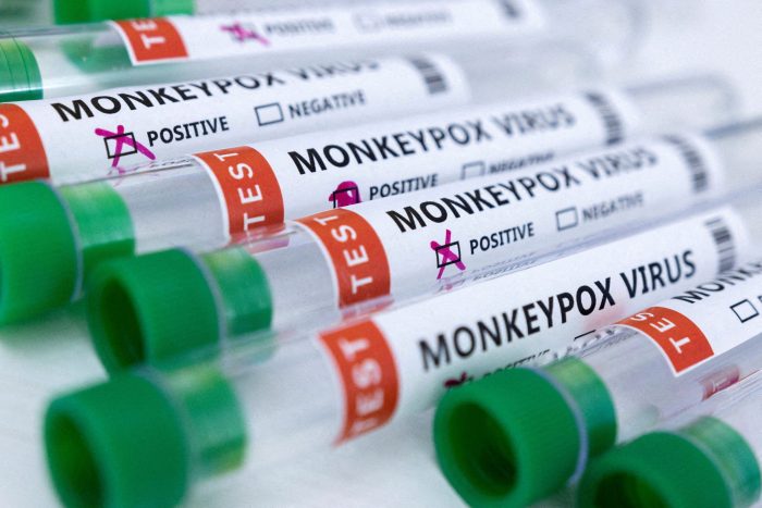 Perú reporta primera muerte relacionada a la viruela del mono