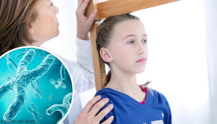 Síndrome de Turner: la patología que afecta en el desarrollo a más de un millón y medio de niñas en el mundo