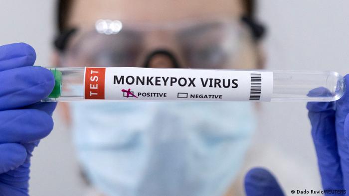 OMS levanta la emergencia internacional por la viruela del mono tras 10 meses de alerta