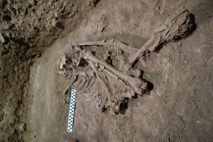 La primera amputación quirúrgica se habría realizado hace 31.000 años
