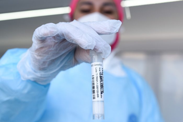 Reporte diario Covid-19: 6.930 nuevos contagios, 30 fallecidos y casos activos llegan a 19.591