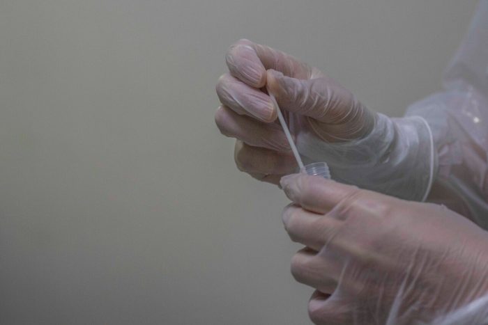 Reporte diario Covid-19: 2.977 casos nuevos, 13 fallecidos y positividad alcanza el 15,11%