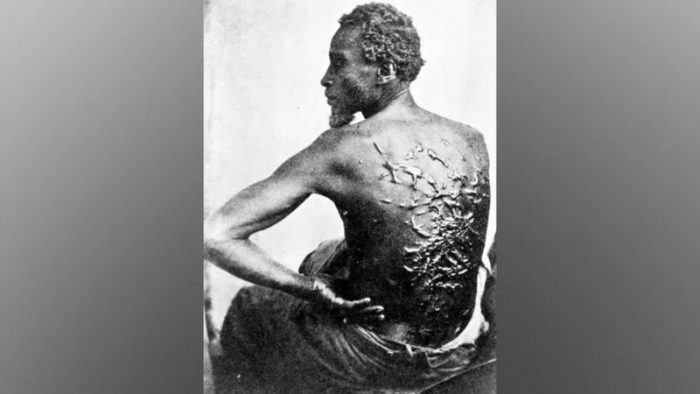 La verdadera historia de «Peter azotado», el esclavo cuya desgarradora fotografía cambió la percepción de la esclavitud en Estados Unidos